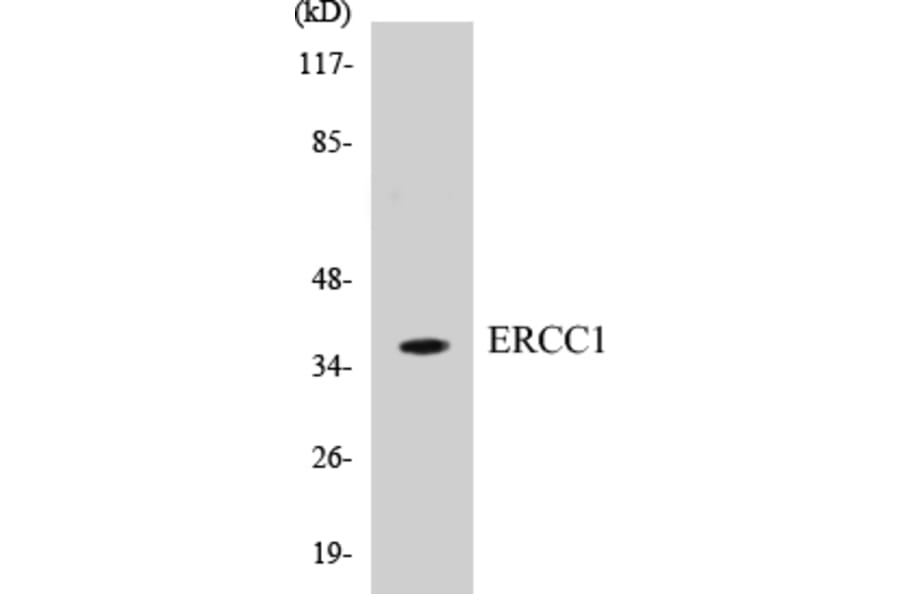 Western Blot - ERCC1 Cell Based ELISA Kit (CB5246) - Antibodies.com