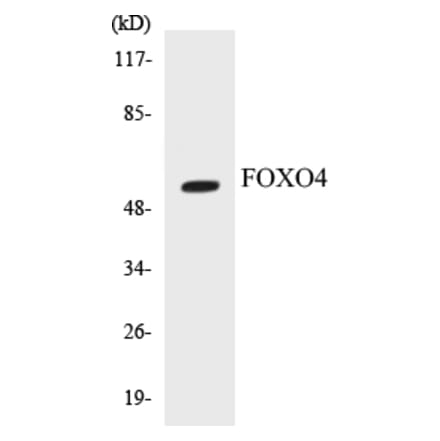 Western Blot - FOXO4 Cell Based ELISA Kit (CB5276) - Antibodies.com