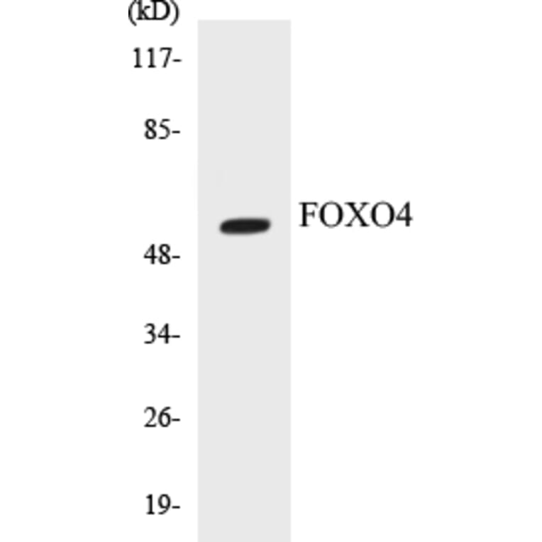 Western Blot - FOXO4 Cell Based ELISA Kit (CB5276) - Antibodies.com