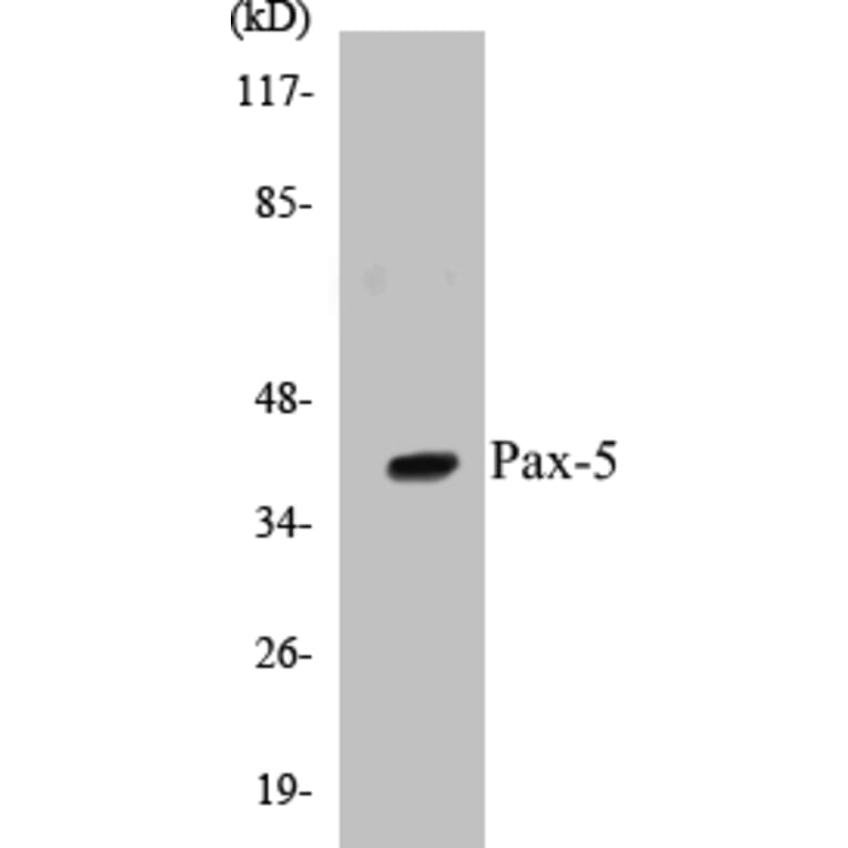 Western Blot - Pax-5 Cell Based ELISA Kit (CB5537) - Antibodies.com
