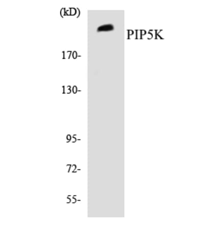 Western Blot - PIP5K Cell Based ELISA Kit (CB5559) - Antibodies.com