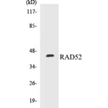 Western Blot - RAD52 Cell Based ELISA Kit (CB5599) - Antibodies.com