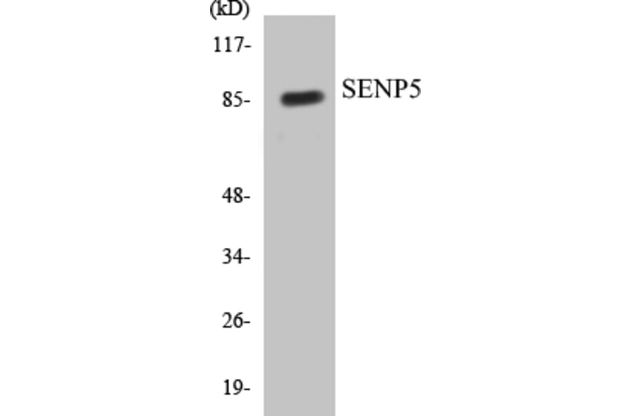 Western Blot - SENP5 Cell Based ELISA Kit (CB5622) - Antibodies.com