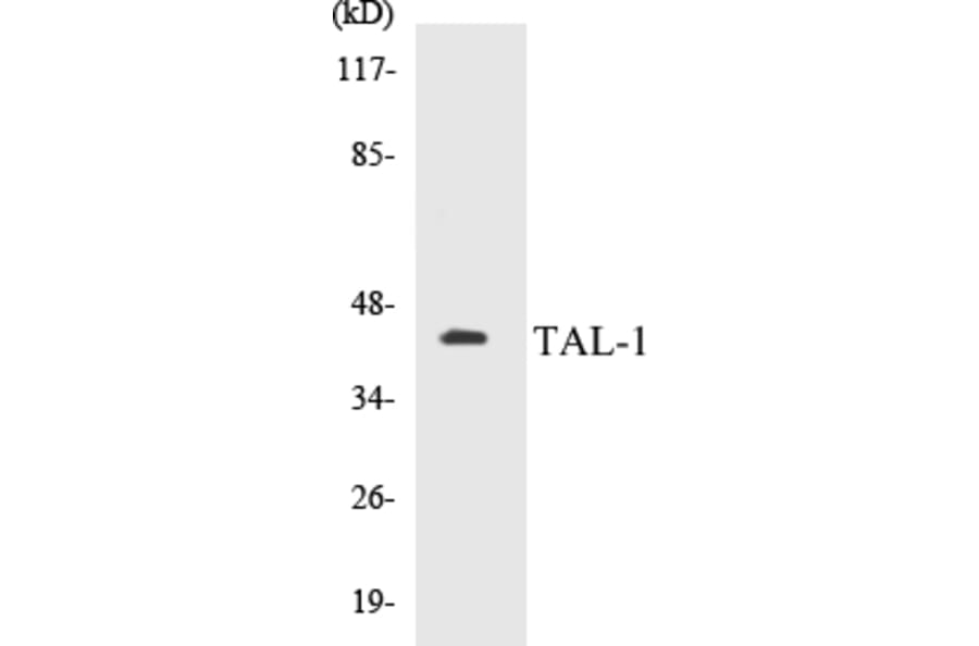 Western Blot - TAL-1 Cell Based ELISA Kit (CB5675) - Antibodies.com