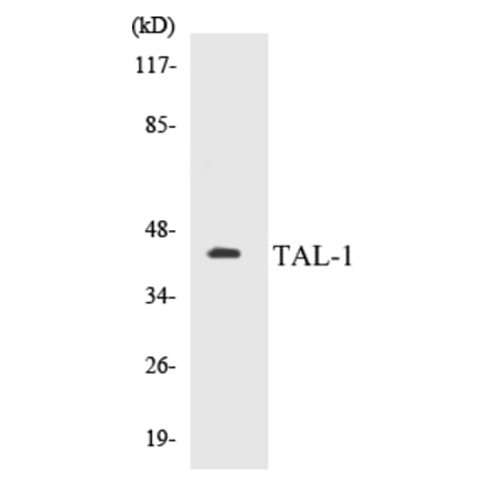 Western Blot - TAL-1 Cell Based ELISA Kit (CB5675) - Antibodies.com