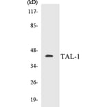 Western Blot - TAL-1 Cell Based ELISA Kit (CB5675) - Antibodies.com