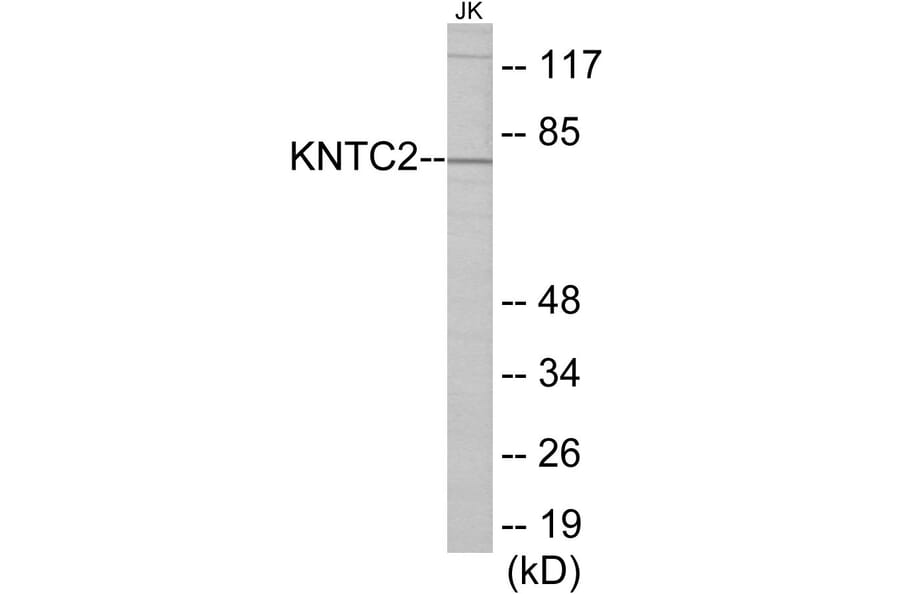 Western Blot - KNTC2 Cell Based ELISA Kit (CB5770) - Antibodies.com