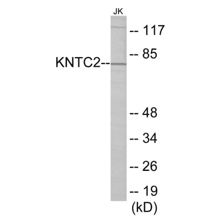 Western Blot - KNTC2 Cell Based ELISA Kit (CB5770) - Antibodies.com