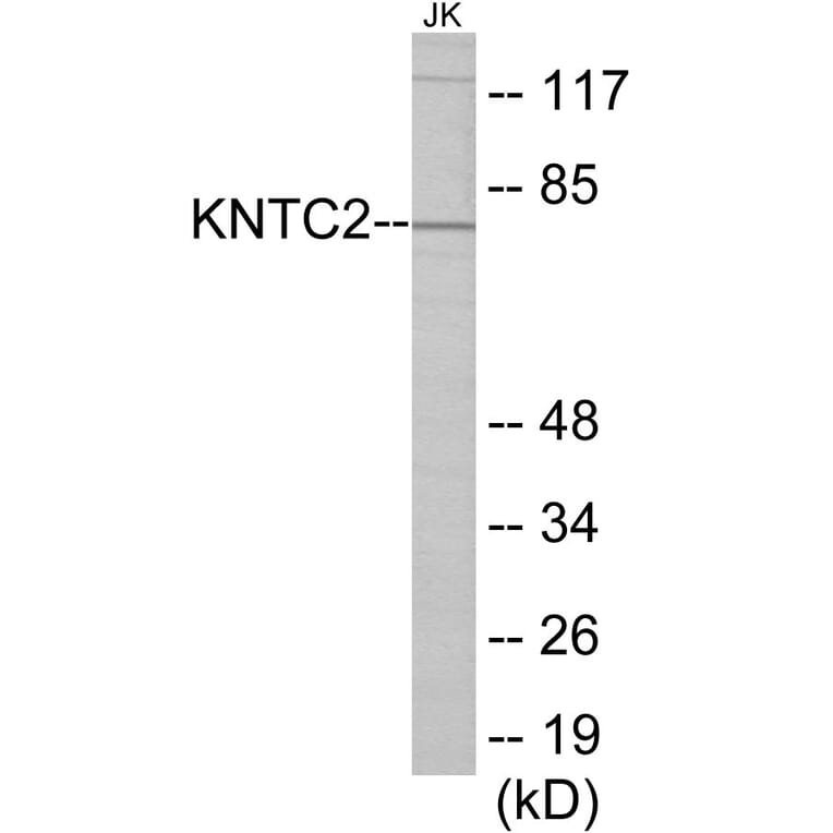 Western Blot - KNTC2 Cell Based ELISA Kit (CB5770) - Antibodies.com