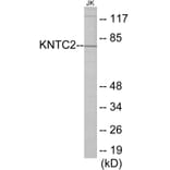 Western Blot - KNTC2 Cell Based ELISA Kit (CB5770) - Antibodies.com