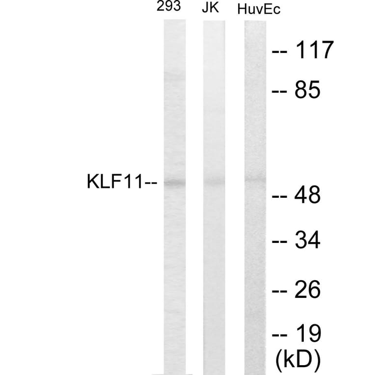 Western Blot - KLF11 Cell Based ELISA Kit (CB5773) - Antibodies.com