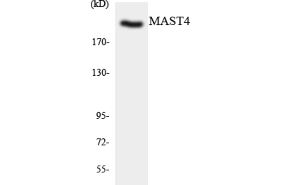 Western Blot - MAST4 Cell Based ELISA Kit (CB5775) - Antibodies.com
