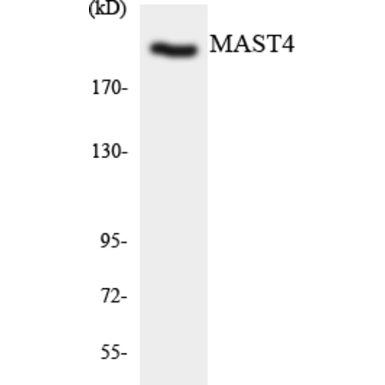 Western Blot - MAST4 Cell Based ELISA Kit (CB5775) - Antibodies.com