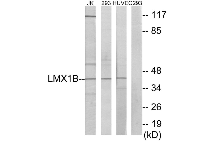 Western Blot - LMX1B Cell Based ELISA Kit (CB5793) - Antibodies.com