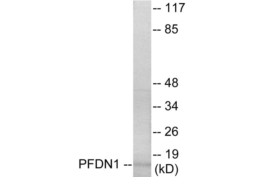 Western Blot - PFDN1 Cell Based ELISA Kit (CB5796) - Antibodies.com