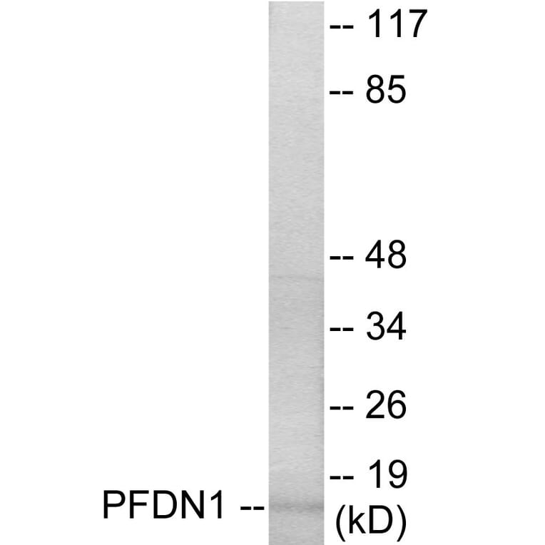 Western Blot - PFDN1 Cell Based ELISA Kit (CB5796) - Antibodies.com