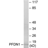 Western Blot - PFDN1 Cell Based ELISA Kit (CB5796) - Antibodies.com