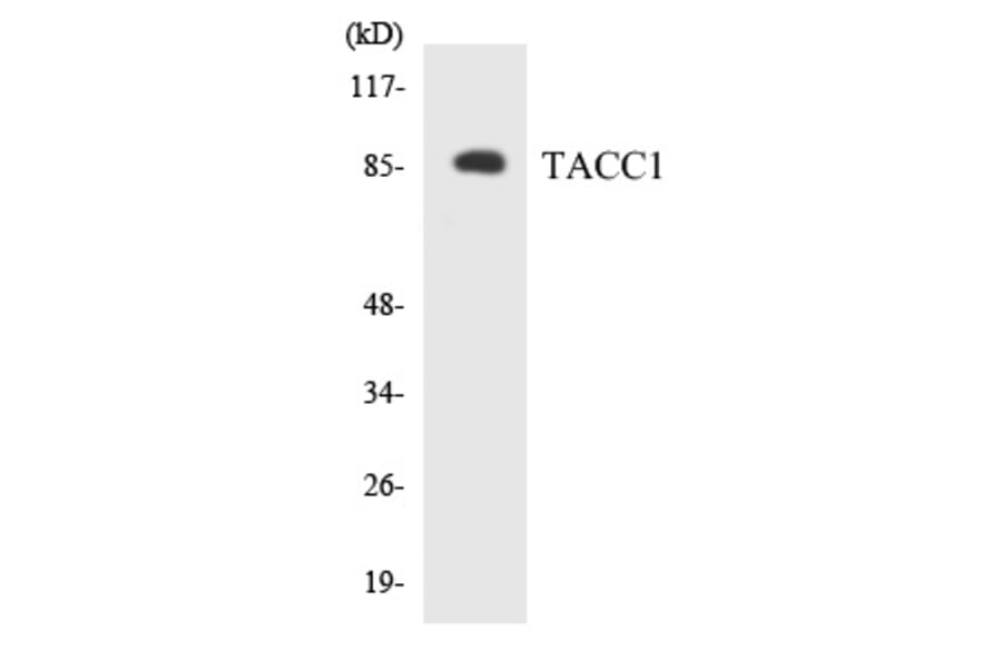Western Blot - TACC1 Cell Based ELISA Kit (CB5800) - Antibodies.com