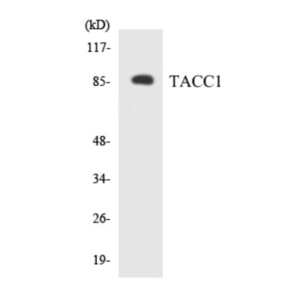 Western Blot - TACC1 Cell Based ELISA Kit (CB5800) - Antibodies.com