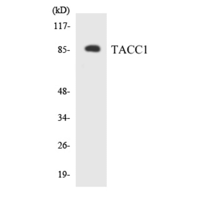 Western Blot - TACC1 Cell Based ELISA Kit (CB5800) - Antibodies.com