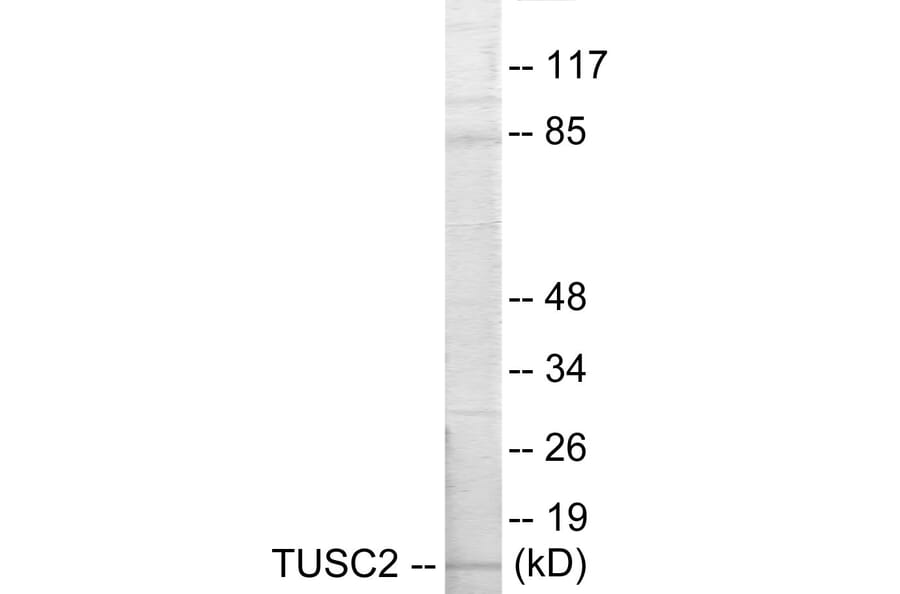 Western Blot - TUSC2 Cell Based ELISA Kit (CB5808) - Antibodies.com