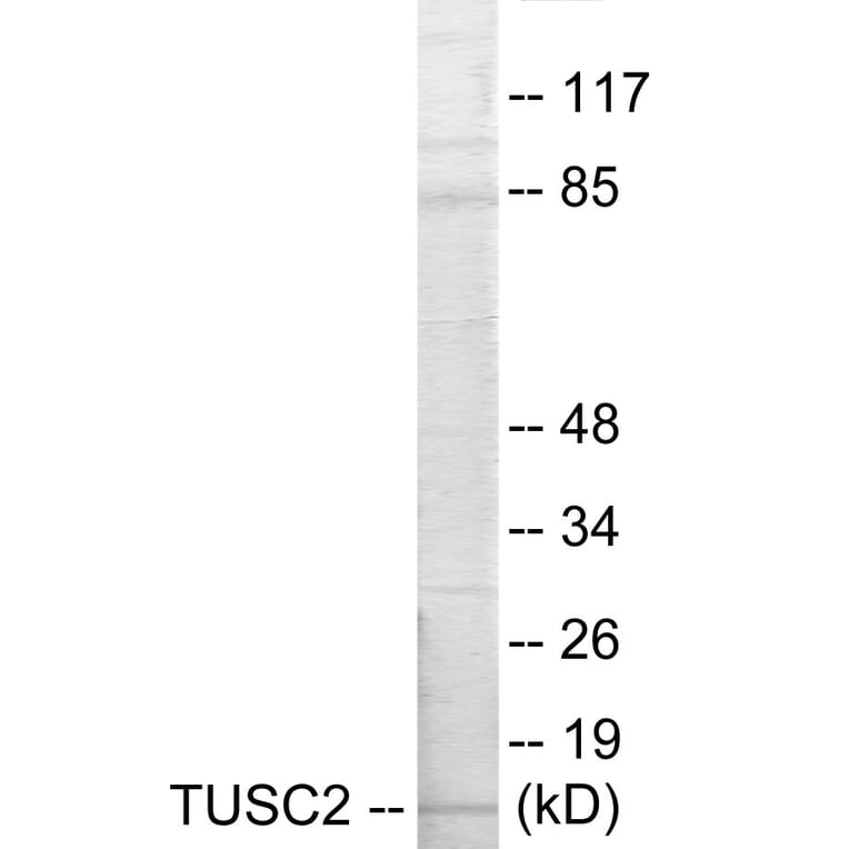Western Blot - TUSC2 Cell Based ELISA Kit (CB5808) - Antibodies.com