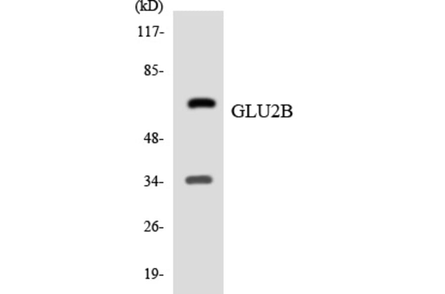Western Blot - GLU2B Cell Based ELISA Kit (CB5840) - Antibodies.com