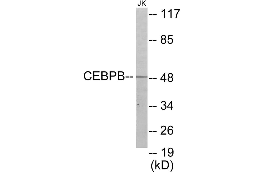 Western Blot - CEBPB Cell Based ELISA Kit (CB5848) - Antibodies.com
