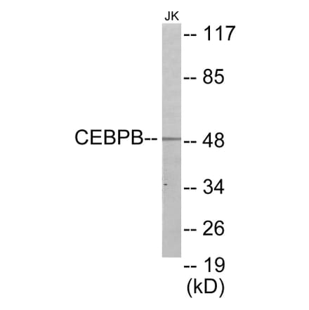Western Blot - CEBPB Cell Based ELISA Kit (CB5848) - Antibodies.com
