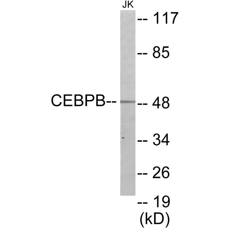 Western Blot - CEBPB Cell Based ELISA Kit (CB5848) - Antibodies.com