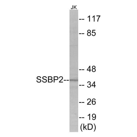 Western Blot - SSBP2 Cell Based ELISA Kit (CB5944) - Antibodies.com