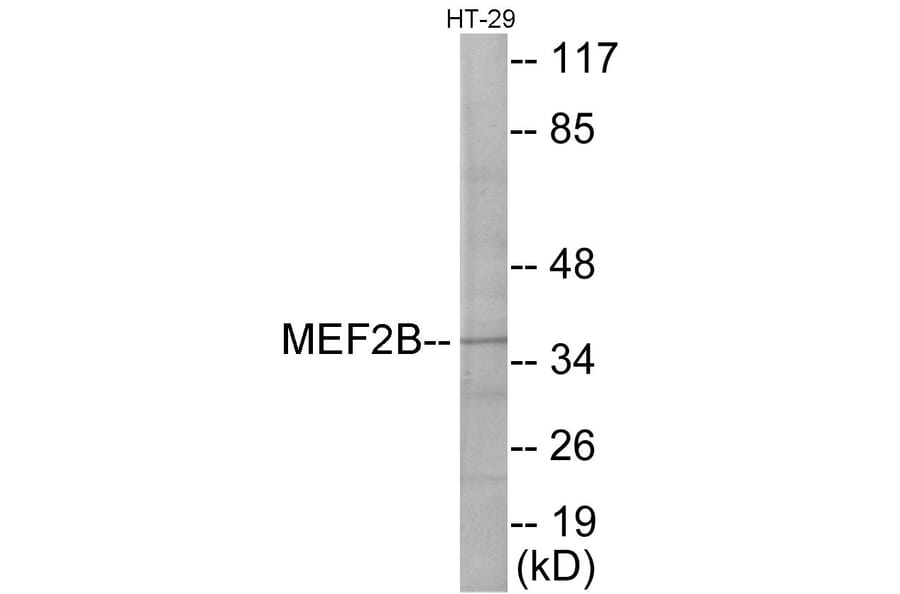 Western Blot - MEF2B Cell Based ELISA Kit (CB5952) - Antibodies.com
