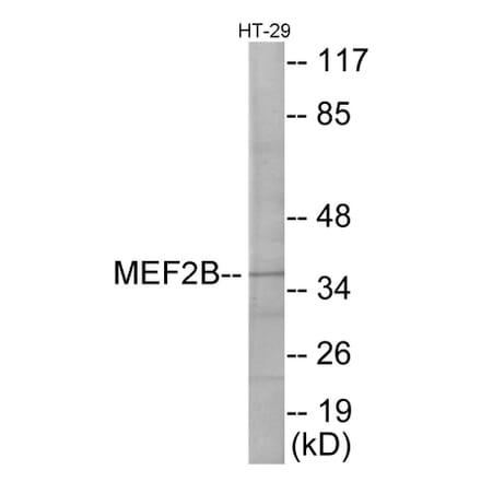 Western Blot - MEF2B Cell Based ELISA Kit (CB5952) - Antibodies.com