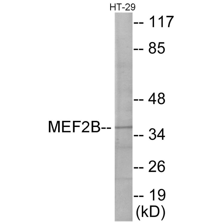 Western Blot - MEF2B Cell Based ELISA Kit (CB5952) - Antibodies.com