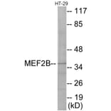 Western Blot - MEF2B Cell Based ELISA Kit (CB5952) - Antibodies.com