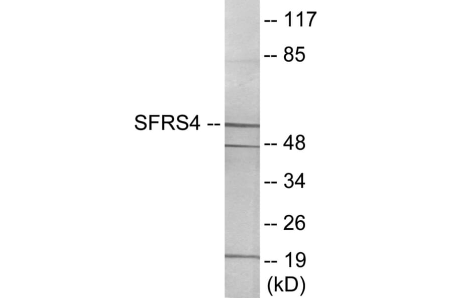 Western Blot - SFRS4 Cell Based ELISA Kit (CB5967) - Antibodies.com