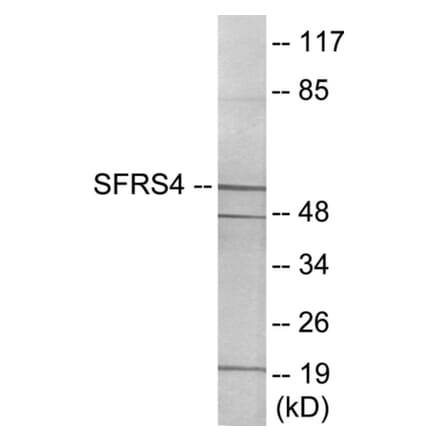 Western Blot - SFRS4 Cell Based ELISA Kit (CB5967) - Antibodies.com