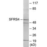 Western Blot - SFRS4 Cell Based ELISA Kit (CB5967) - Antibodies.com