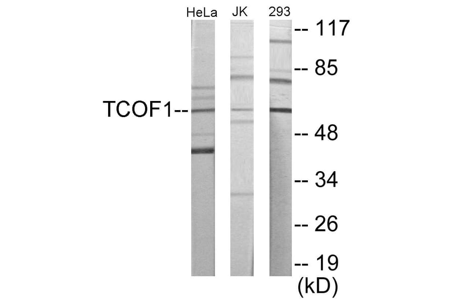 Western Blot - TCOF1 Cell Based ELISA Kit (CB5988) - Antibodies.com