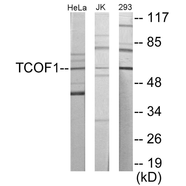 Western Blot - TCOF1 Cell Based ELISA Kit (CB5988) - Antibodies.com