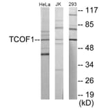 Western Blot - TCOF1 Cell Based ELISA Kit (CB5988) - Antibodies.com