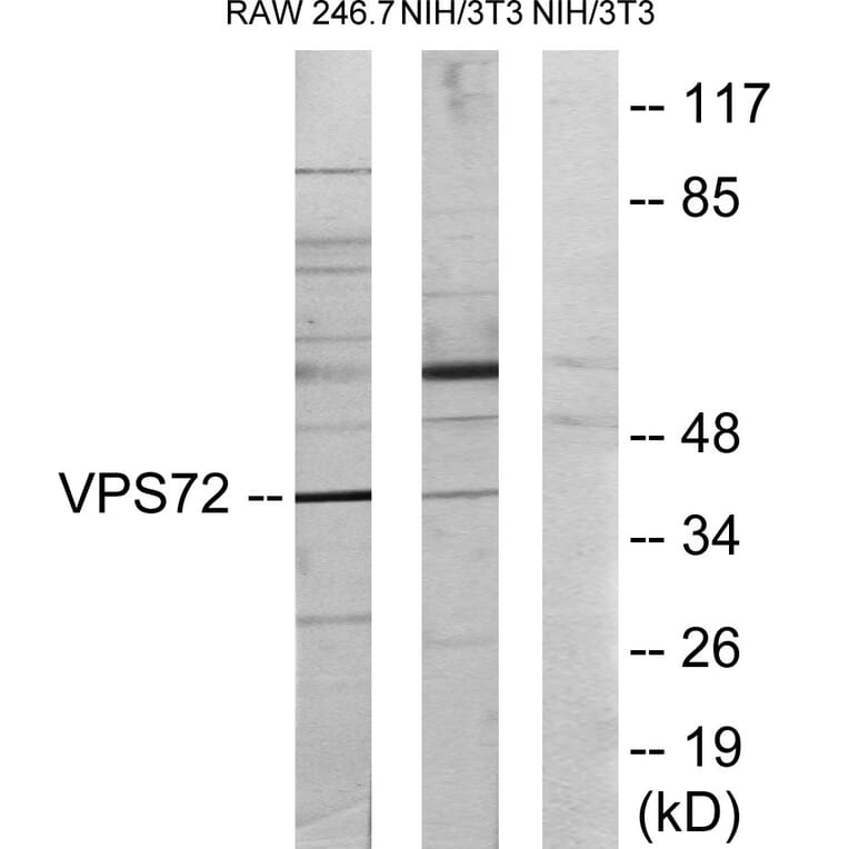 Western Blot - VPS72 Cell Based ELISA Kit (CB6034) - Antibodies.com