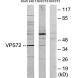 Western Blot - VPS72 Cell Based ELISA Kit (CB6034) - Antibodies.com