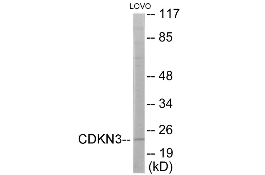 Western Blot - CDKN3 Cell Based ELISA Kit (CB6039) - Antibodies.com
