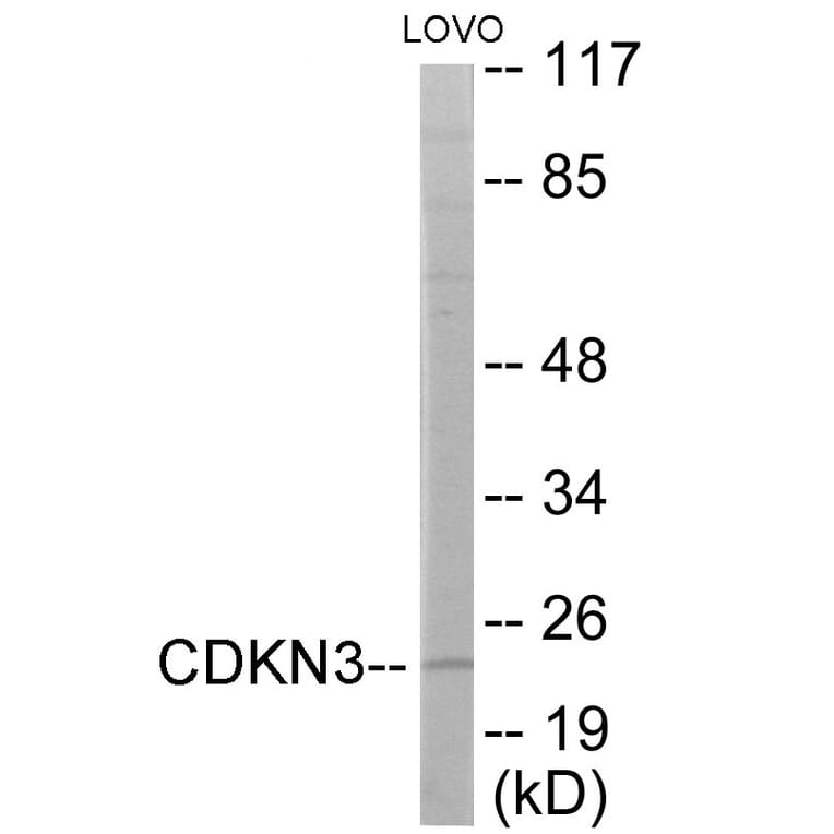 Western Blot - CDKN3 Cell Based ELISA Kit (CB6039) - Antibodies.com