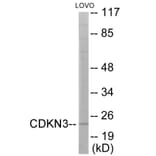 Western Blot - CDKN3 Cell Based ELISA Kit (CB6039) - Antibodies.com