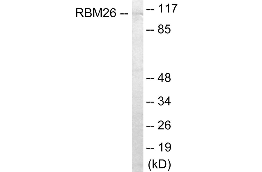 Western Blot - RBM26 Cell Based ELISA Kit (CB6056) - Antibodies.com