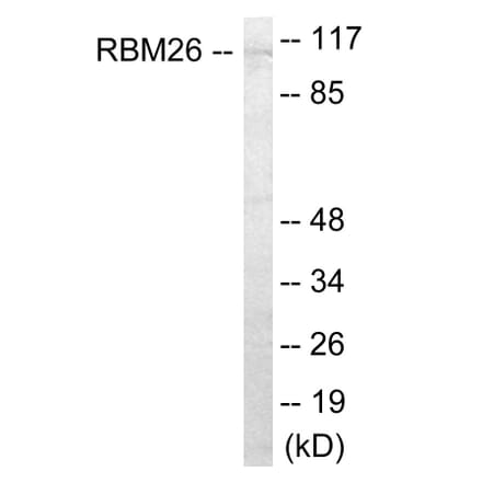 Western Blot - RBM26 Cell Based ELISA Kit (CB6056) - Antibodies.com