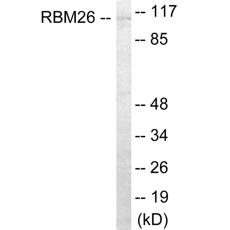 Western Blot - RBM26 Cell Based ELISA Kit (CB6056) - Antibodies.com