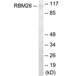 Western Blot - RBM26 Cell Based ELISA Kit (CB6056) - Antibodies.com